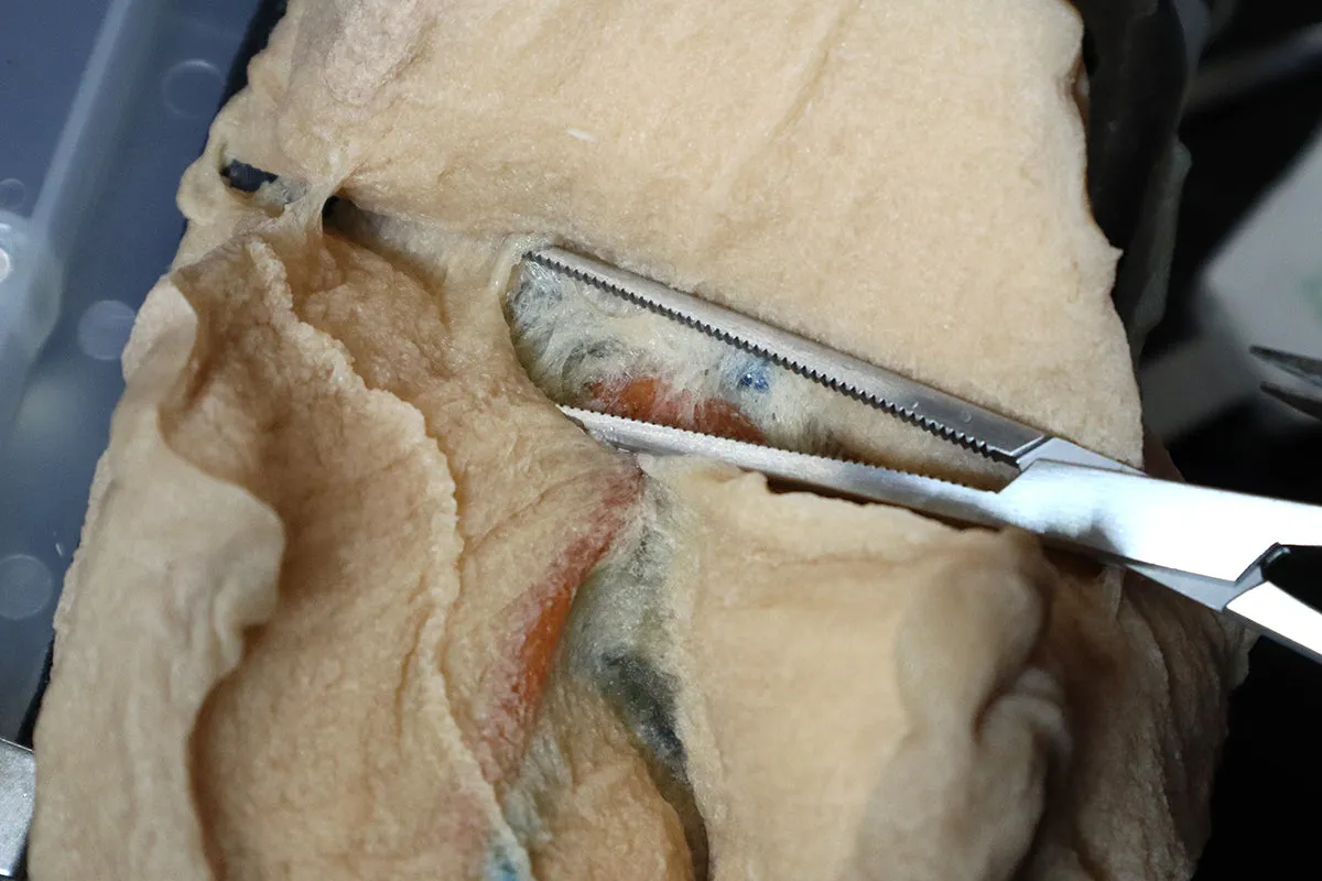 Right Lobectomy Model