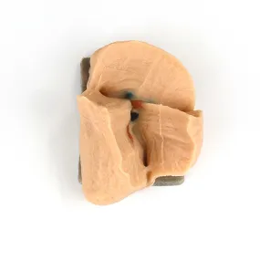 Right Lobectomy Model