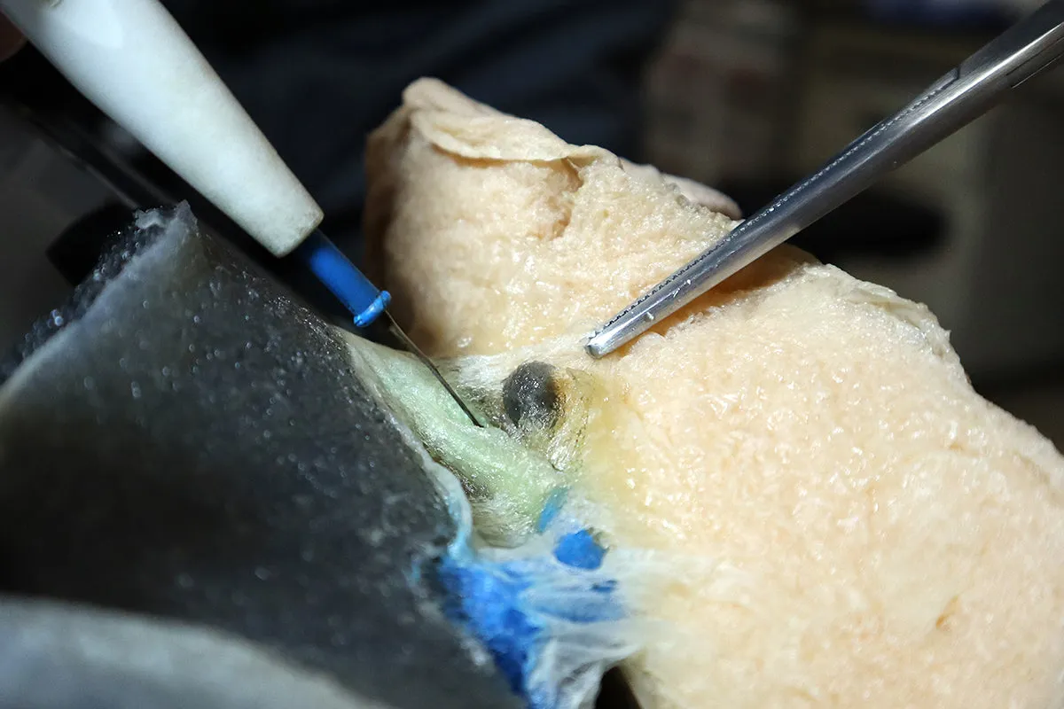 Right Lobectomy Model