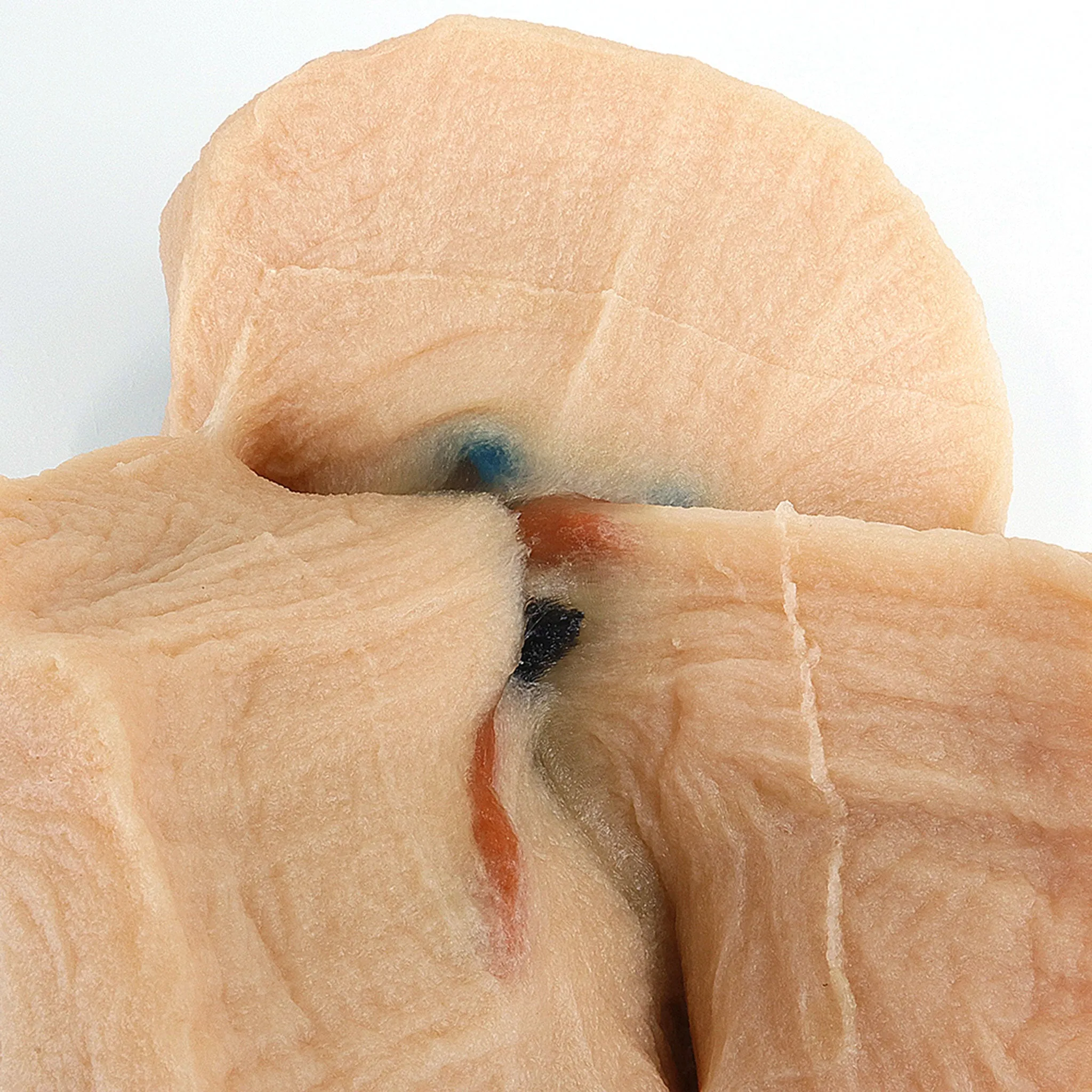 Right Lobectomy Model